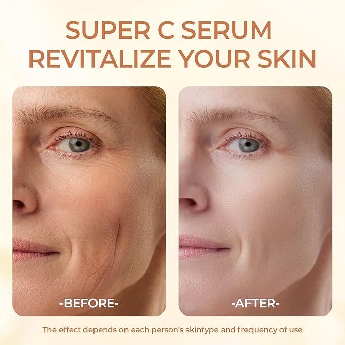Super Vitamin C Serum for Women - Hydrating Anti-Aging with Vitamin C Caffeine - Facial Skin Care Over 50 60 70, Firming, Lifting, Smoothing 50ml