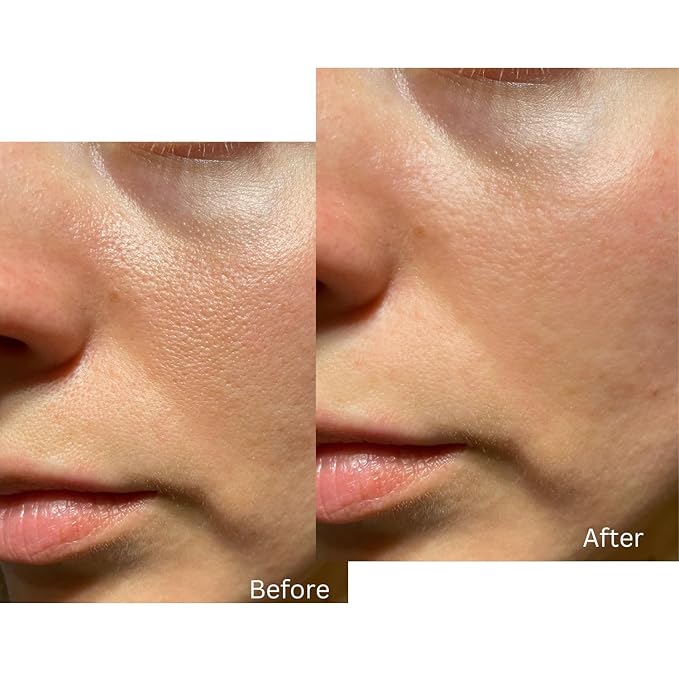 Your Face Lift In A Bottle - 2.5% Encapsulated Retinol Cream for Ultimate Age-Defying Support. W/Shea Butter + Vitamin A, C, and B3. 50ml anti-aging cream.