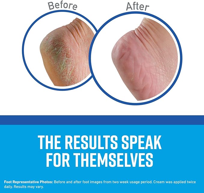 O'Keeffe's Healthy Feet Jar, Tube, and Lip Repair SPF Variety Pack