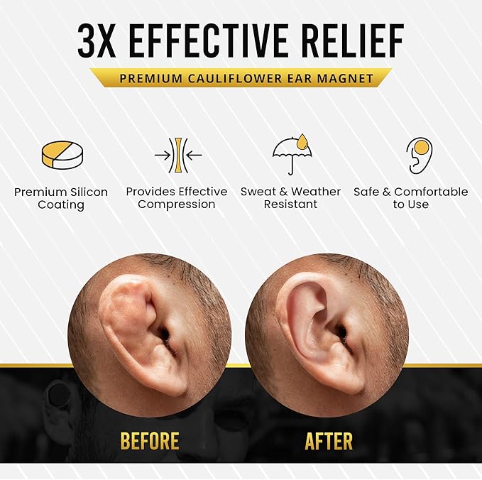 MagnetRX® Cauliflower Ear Magnets – 8 Multi–Size Magnets & Spacer with Case – Compression Ear Magnet for Cauliflower Draining, Pressure Earring for Keloids, BJJ, Wrestling & MMA Treatment & Prevention