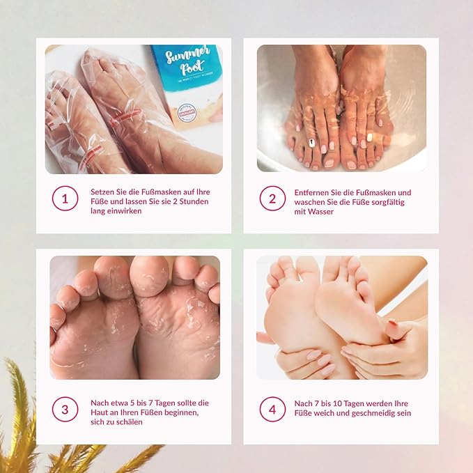 Peeling Mask That Removes Dead Skin - Dermatologically Tested Callus Remover for Dry Cracked Feet - Exfoliating Foot Peel Mask for Baby Soft Feet - Cucumber & Urea Extracts