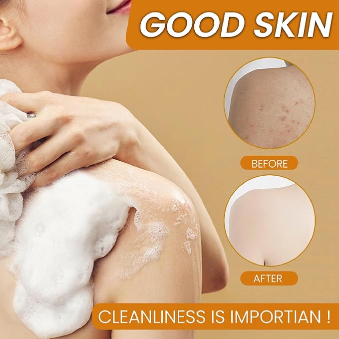 Lemon Turmeric Kojic Soap Fragrance, Honey Glow Lemon Turmeric Soap for Face and Body (4)