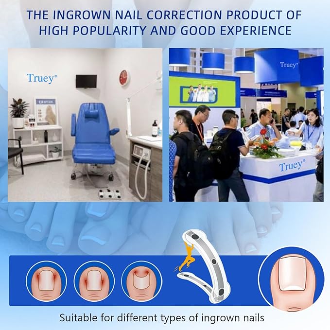 Titanium Alloy Silicone Ingrown Toenail Treatment, correction patch, Ingrown Toenail Corrector, Nail correction tool,Ingrown Toenail Removal Kit,Cuttable Applicable for any nail size,Reusable