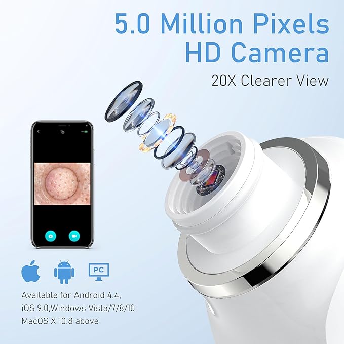 Blackhead Remover Vacuum with HD Camera, USB Rechargeable Pore Cleaner for Men and Women, 6 Suction Heads & 3 Adjustable Power Levels(Orange)