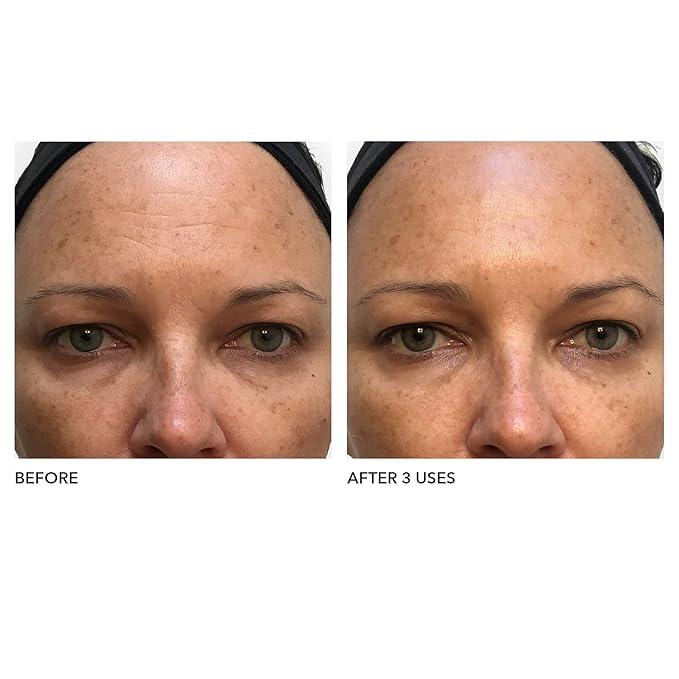 Algenist Blue Algae Vitamin C Dark Spot Correcting Peel - Visibly Reduce the Appearance of Discoloration - Exfoliating AHAs, BHA & PHA to Brighten & Even Skin Tone (45ml)