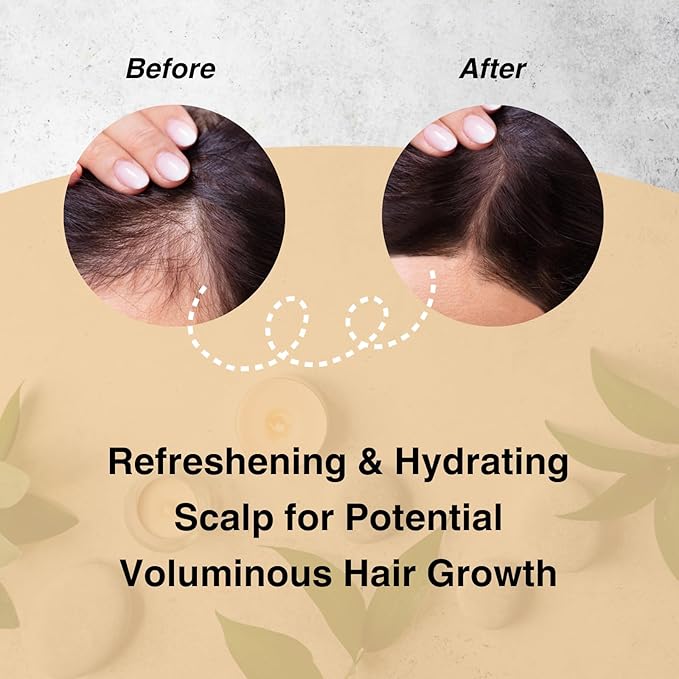 Moist Diane Keratin Shampoo and Conditioner Set for Hair Fall & Itchy Scalp Women & Men, Organic Hair Care with Argan Oil & Keratin from Japan, Silicone& Sulfate Free, VOLUME& SCALP 30.4 Fl Oz