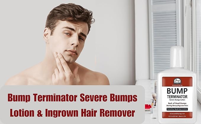 BUMP Terminator Razor Bumps & Shaving Bumps Remover | Ingrown Hair Treatment for Pubic Area with Glycolic Acid, Salicylic acid & Tea Tree Oil| BREEJ Bump Treatment for Bikini Bumps, 6.8 oz (Pack of 1)
