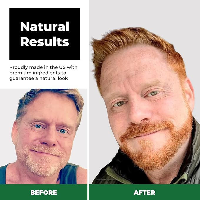 Simpler Hair Color Ginger Mustache and Beard Upgraded Brush Kit with 3 Brushes Included for Precision Application - Gentle, Natural Looking Ammonia Free Beard and Hair Dye for Men