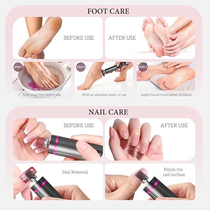 Ranrose Professional Electric Callus Remover - 9-Speed Rechargeable Foot File for Cracked Heels & Dead Skin, Portable Pedicure Tool with 2 Discs, Wireless & Anti-Slip Grip (Home/Spa/Travel)