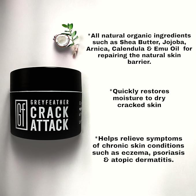 Greyfeather Crack Attack Hand Cream for Dry Cracked Hands & Feet, Skin Repair Cream for Gardeners, Nurses, Bug Bites, Rashes, Gift for Father's & Mother’s Day, Weddings, Outdoor Use (8 oz)