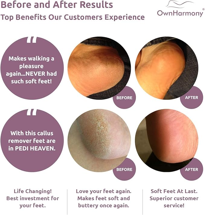 Own Harmony Electric Callus Remover for Feet and 6 Rollers Bundle: Rechargeable Pedicure Tools & Professional Foot Care for Women - Electronic Foot File Sander - Best for Hard Dry, Dead, Cracked Skin