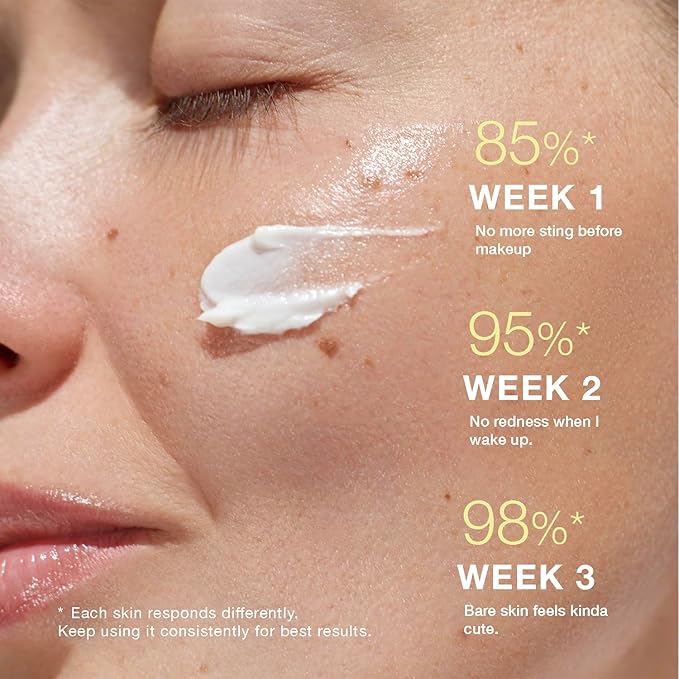 Beef Tallow for Skin:Whipped Tallow Face Moisturizer, Deep Hydration & Nourishment for All Skin Types, Beef Tallow Face Moisturizer 4oz