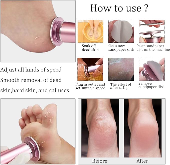 Electric Foot File Callus Remover Professional Foot Sander Grinder Scrubber Foot File Pedicure Tools Adjustable Speed 60 Replacement Sandpaper disc Easy to Remove Cutin Dead Skin calluses-Rose Gold