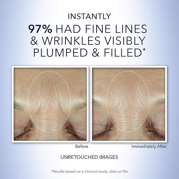 RoC Derm Correxion Fill + Treat Advanced Retinol Serum, Wrinkle Filler Treatment with Hyaluronic Acid for Crow's Feet, 11 Wrinkles, & Laugh Lines, (.5 fl oz) with Retinol Packette (Packaging May Vary)