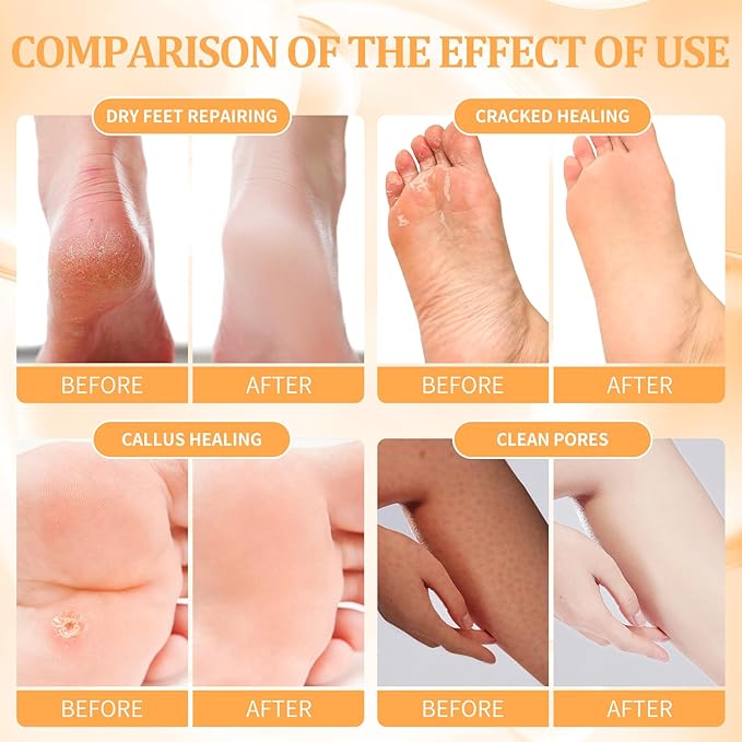 Foot Pedicure Spa Set,Foot Soak Spa Home Pedicure Kit with Bath Salt, Moisturizing Foot Scrub Cream Lotion, Foot Care for Dead Skin, Dry Cracked Feet, Make Baby Soft Feet, 3 Set