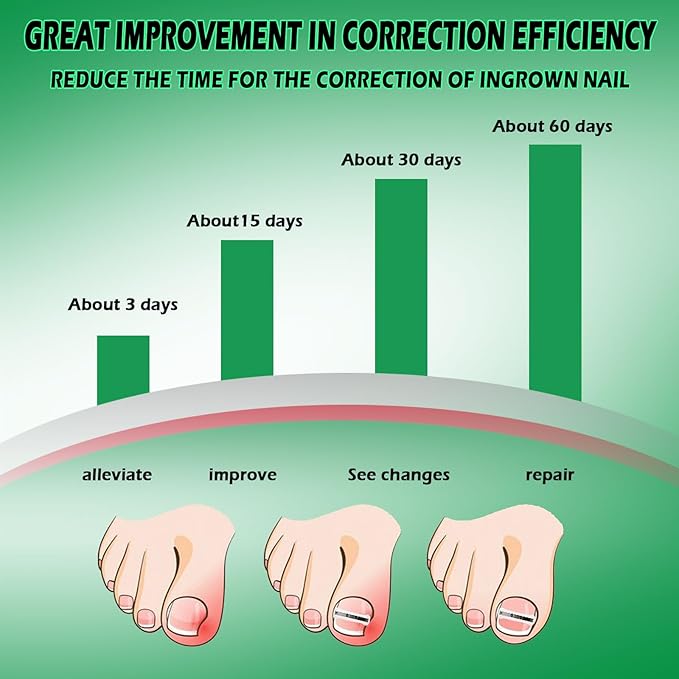 Titanium Alloy Silicone Ingrown Correction Tool Kit,Ingrown Toenail Treatment,Ingrown Toenail Removal Kit,Designed for Ingrown Nail Repair, nail Corrector, Cuttable Applicable to most sizes,reusable