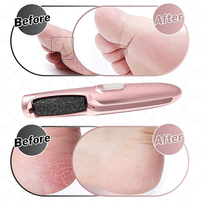 Powerful Electric Callus Remover Wand – Rechargeable Foot File, Grinder & Scrubber - Removes Dry, Dead, Hard Skin & Calluses – Best Pedicure Tool for Soft, Smooth Feet for Men & Women