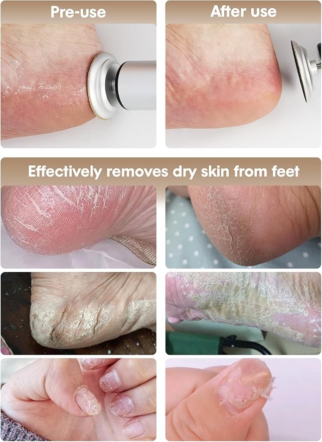 Electric Feet Callus Remover - 2 in 1 Cordless Electric Foot File Nail Grinder,Electric Callus Remover for Feet with 3 Modes,Dry Skin Remover for Feet (Silver)