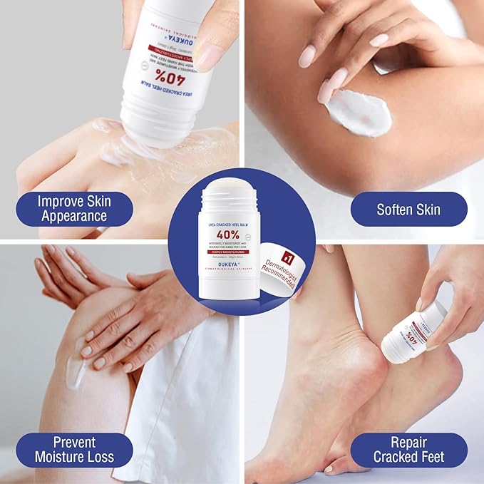 Urea Cream Stick 40 Percent,Heel Balm,Hand Cream and Foot Cream for Dry Cracked,Cracked Heel Treatment,Avoid Frostbite,40 Percent Urea Lotion for Feet Maximum Strength