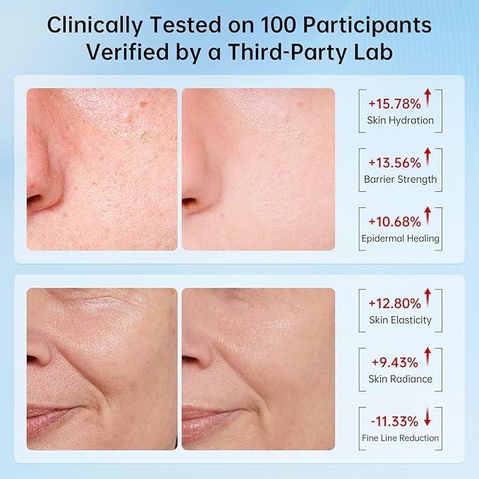 VGO Snail Mucin 92% Face Moisturizer – Anti Aging, Skin Repair & Hydrating Face Cream with Ceramide & Vitamin E, 1.76 oz