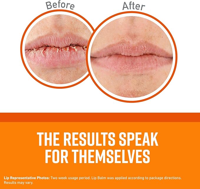 O'Keeffe's Lip Repair Lip Balm for Dry, Cracked Lips, Stick, (Pack of 4: 2 Cooling + 2 Unscented)