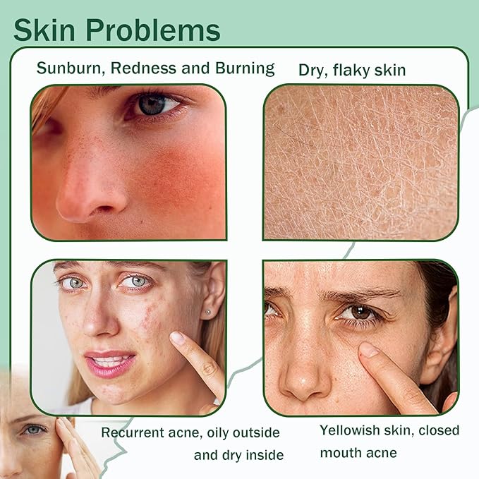 Moisturizing Gel for Face & Body,Non-sticky Gel After Sun Aloe Lotion Skin Care,Fast Absorbing Long Lasting Refreshing Hydrating Face Moisturizer for All Skin Types 03