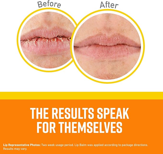 O'Keeffe's Healthy Feet Jar, Tube, and Lip Repair SPF Variety Pack