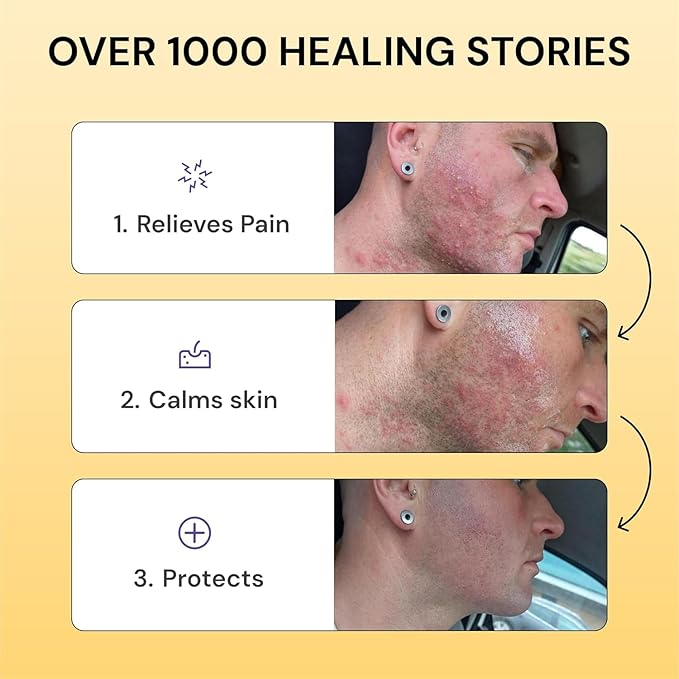 Thyme & Tea Tree Flare Care | Solution for Painful Pimples, Cystic Acne, Ingrowns, Folliculitis, Groin Flare Ups, Razor Bumps | Bartholin | Safe Flare-Up Solution with Egg Yolk Extract & Tea Tree 1 oz