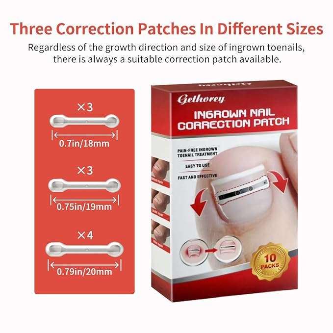 Ingrown Toenail Treatment, 10 packs Titanium Alloy Ingrown Toenail Corrector for all size foot, Ingrown Toenail Removal Kit for Curved Nail Repair, at Home Nail Kit Tools-Q03