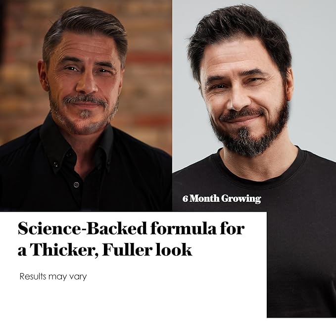 Minoxidil Beard Growth Oil: Minoxidil For Men Beard Infused With Biotin, Extra Strength Minoxidil 5% Beard Growth Serum to Grow Beard & Mustache Fast