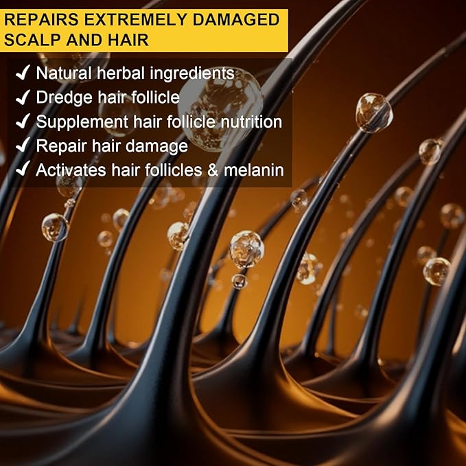 5% Minoxidil Hair Growth Serum, Topical Minoxidil for Men and Women, Hair Regrowth Treatment for Scalp Hair Loss and Thinning, With Biotin