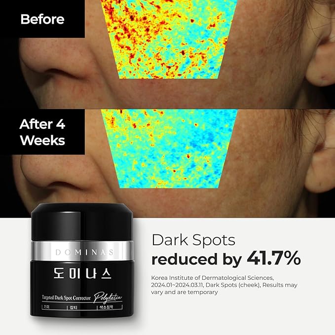 Cream - Advanced Korean Cream for Even Skin Tone and Skin Elasticity Niacinamide, Panthenol, Urea, Trehalose & TECA (1.76oz)