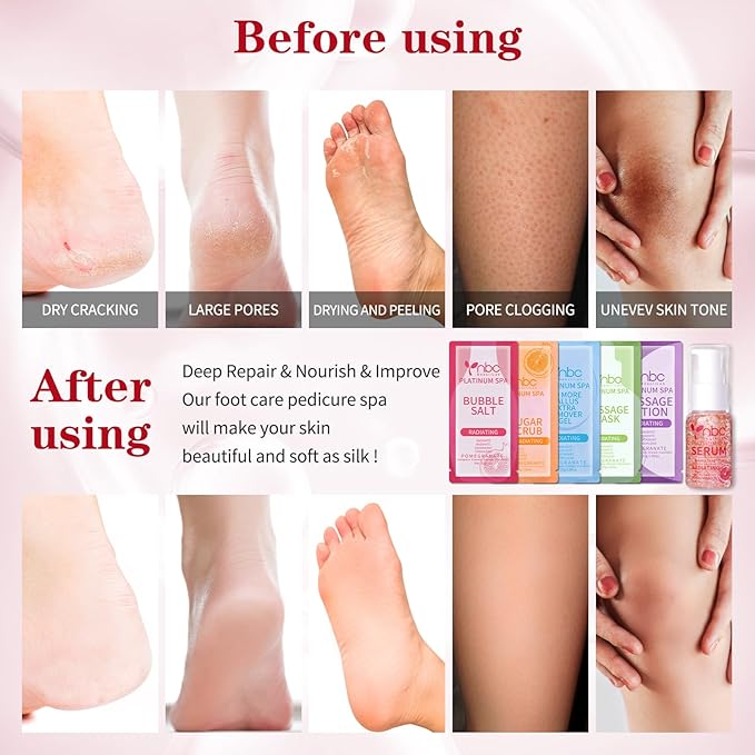 Pedicure Foot Soak Set - Upgraded 6 in 1 Foot Spa, Foot Bath Spa, Pedicure Kit, Foot Soak for Tired & Dry Cracked Feet, Athletes Feet and Calluses (Pomegranate)