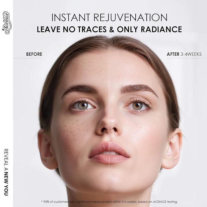 TXA+Niacinamide 15% Glow Facial Serum - Dark Spot remover for face Serum for Uneven Skin Tone, Texture and Hydration After Spot Care, High-Potency Tranexamic Acid Niacinamide Serum (50ml /1.69 fl.oz)