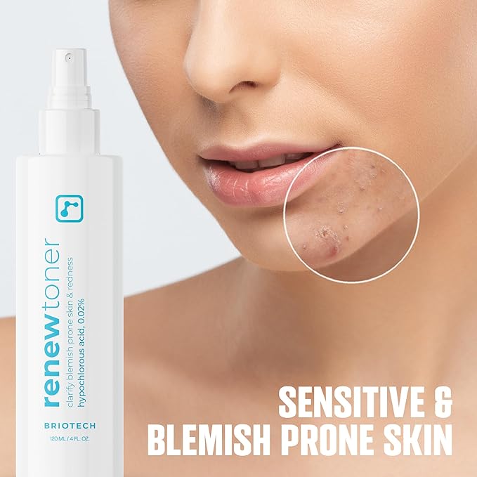 BRIOTECH Skin Renew Toner, Hypochlorous Acid Spray Topical Skin Spray for Face and Skin, Minimize Appearance of Blemishes, Soothing Mist for Redness & Bumps, Stocking Stuffer, 4 fl oz ea, 2 ct