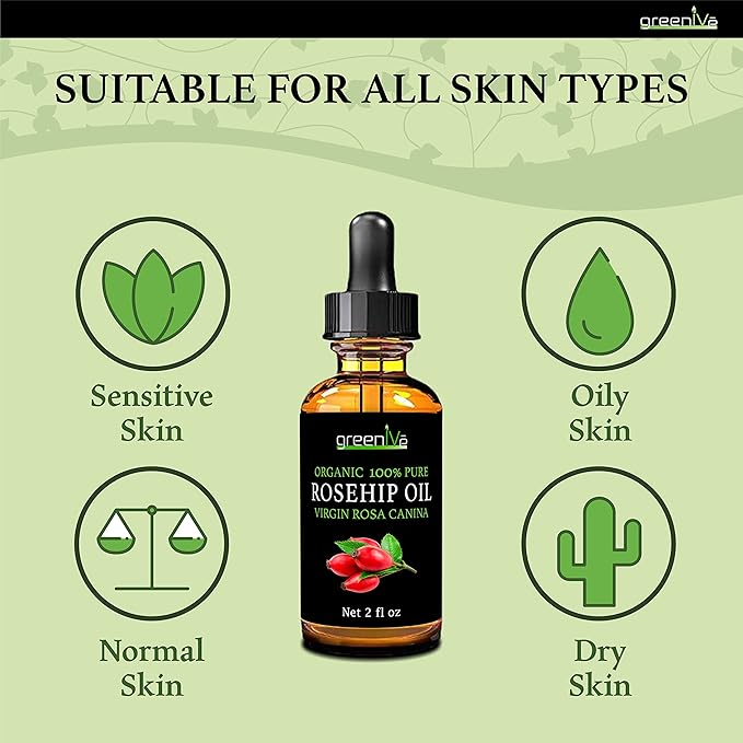 GreenIVe Organically Grown Rosehip Oil Rosa Canina 100% Pure Cold Pressed Virgin Oil Exclusively on Amazon (8 Fl Oz)