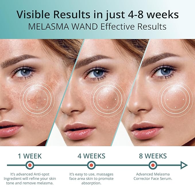 Abera Melasma Serum Plus with Niacinamide and Hyaluronic Acid, Dark Spot Corrector Serum, Melasma Treatment for Face, Suitable for All Skin Types, Set of 2