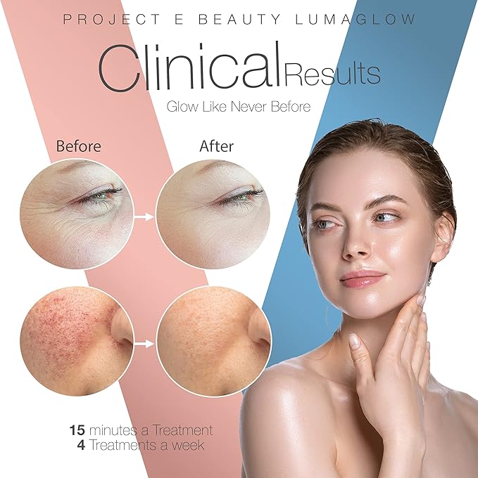 Project E Beauty LumaGlow Red & Blue LED Light Therapy Anti-Aging & Anti-Acne | Fine Lines & Wrinkles Scars | FDA-Cleared Handheld Device for Spa & Home Use
