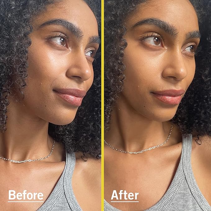 First Aid Beauty - Weightless Liquid Mineral Sunscreen with Zinc Oxide Broad Spectrum SPF 30, Luxuriously Light Ultra Sheer Tint for Everyday Use, Non-comedogenic, Safe for Sensitive Skin, 1.5 oz