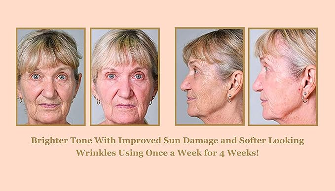 DIAMONDBUFF Microderm Exfoliation Tool for at Home Glowing and Radiant Skin | Reduce Acne, Fine Lines, Wrinkles, & Provide a Velvety Smooth Complexion with Diamond Microdermabrasion