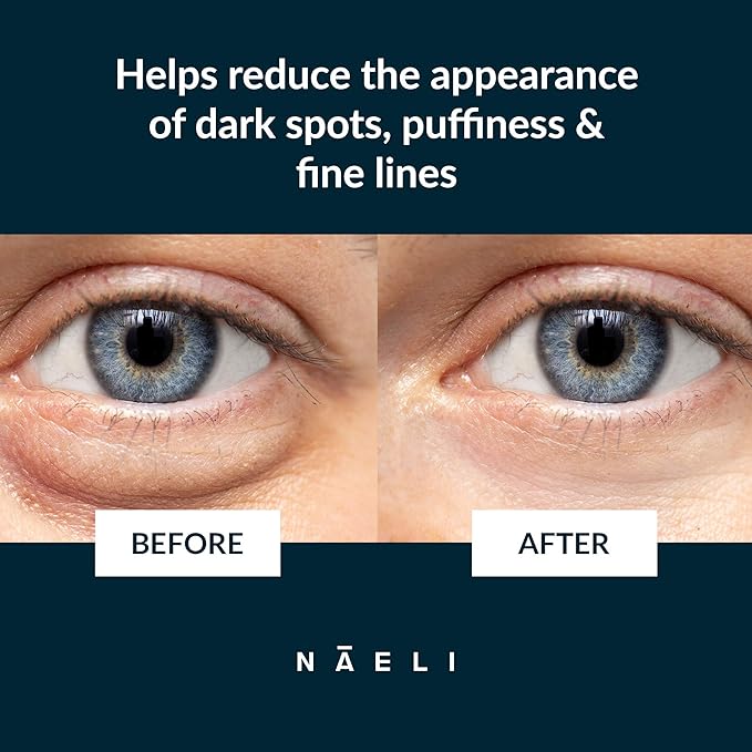 NAELI Eye Cream for Dark Circles, Puffiness & Wrinkles with Anti Aging Apple Stem Cell & Peptide Complex - Reduces Fine Lines, Diminishes Bags & Restores Under Eye, 1.4 oz