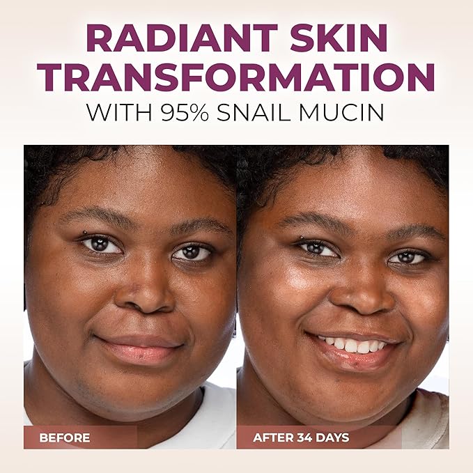 Snail Mucin Serum - Face Hydrating Essence - Hyaluronic, Collagen, Royal Jelly - Advanced 95% Snail Peptide Moisturizer, Barrier Serum - 100 ml