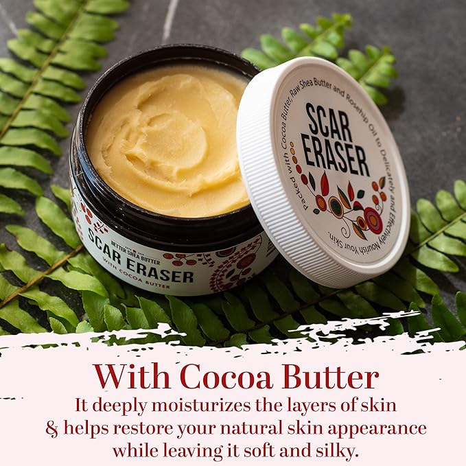 Better Shea Butter Scar Eraser Balm - Cocoa Butter Cream for Stretch Marks and Dark Spots, Burns, Old Scars - Acne Scars - Designed w Zero Synthetic Ingredients, 4 oz