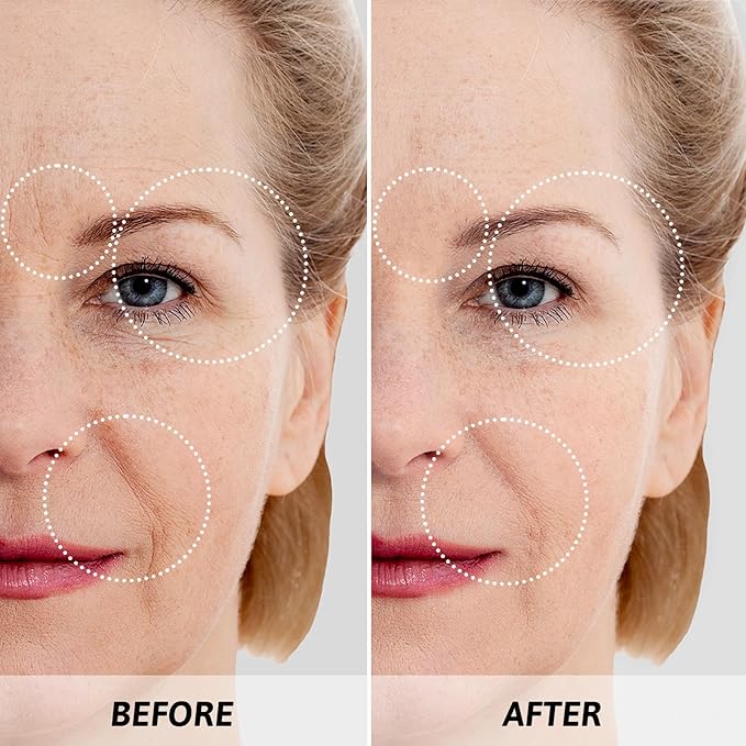 Mother's Day Gifts for Mom Skin Care Routine Kit for Women, Rose Essential Oil+Retinol+ Vitamin E, 10-Piece Complete Skin Care Set, Korean Skin Care Set, Birthday Gifts for Women