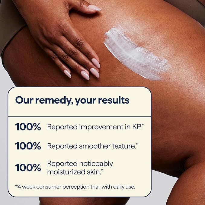 Remedy for Body Bumps – Treatment for Keratosis Pilaris (KP) and Textured, Crepey Skin with Urea, Lactic Acid, and Retinol -– Smoothing Body Moisturizer Lotion – By Dermatologist Dr. Shah