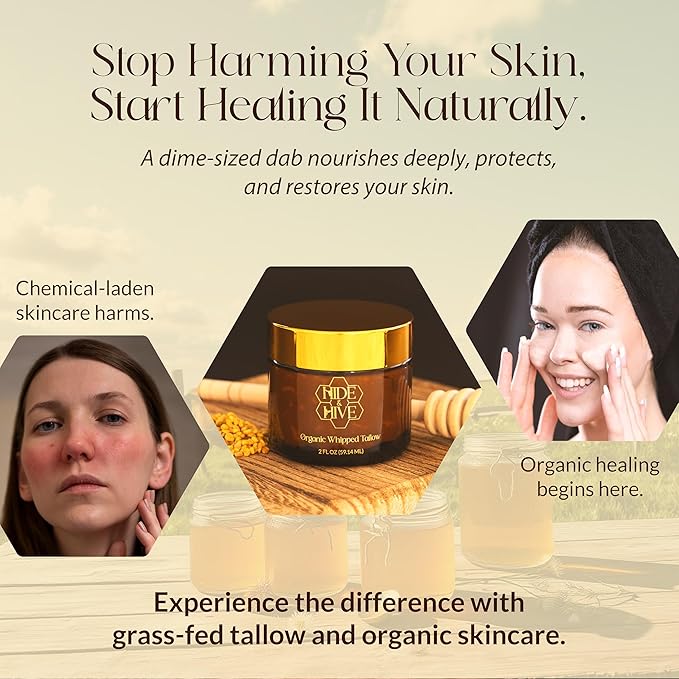 HIDE & HIVE Whipped Tallow Balm – Grass-Fed Moisture for Face, Body & Hands – Organic Beef Tallow for Skin with Royal Jelly & Propolis – Clean, Non-Greasy Balm for Dry, Sensitive Skin