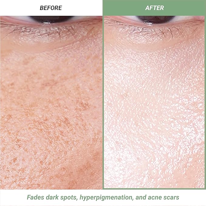 Meebak Korean Vitamin C Serum | Brightening Dark Spot Remover | Soothing Anti Aging & Skin Brightening w/Centella Asiatica, Panthenol, & Adenosine