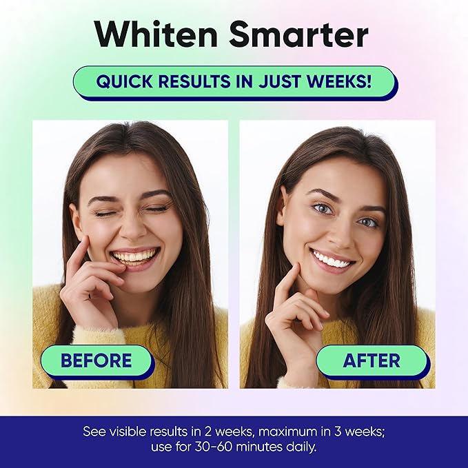 Something Nice Lumismart Whitening Strips - Dentist-Designed, Enamel Safe, up to 42 Treatments with Smart Adjust - Teeth Whitening Strips in Mint for Sensitive Teeth