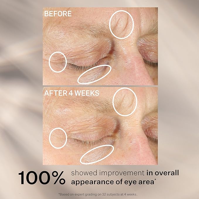 StriVectin Anti-Wrinkle Intensive Eye Cream Concentrate for Wrinkles PLUS, Targets Crow's Feet, Firmness, Puffiness and Dark Circles, 1 Fl oz