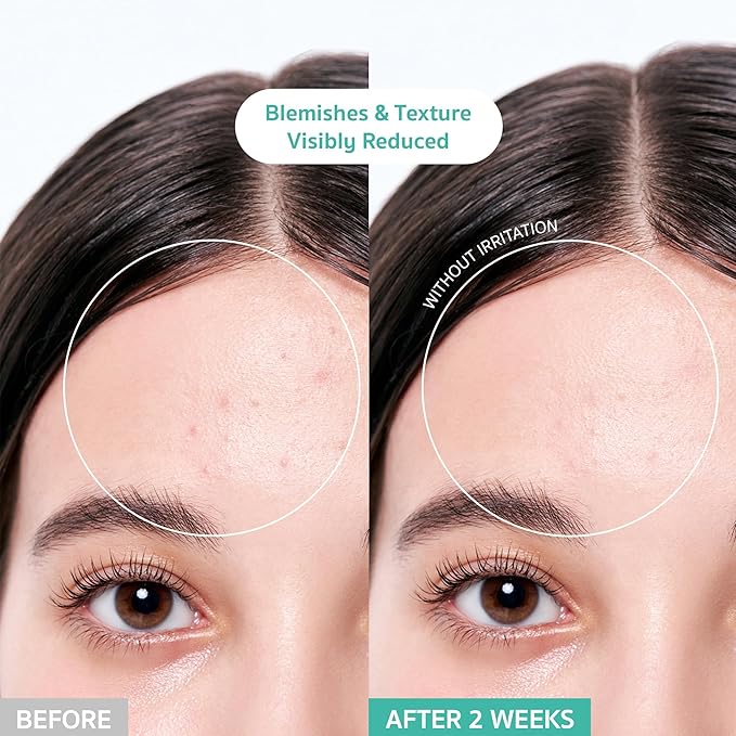 BRING GREEN Tea Tree Cica Soothing Cream Plus 100ml Korean Skin care, calming and soothing, moisturizer for skin, facial cream, trouble care, Blackhead Removing Pore care (Pack of 1)